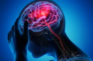 Tekanan Darah Tinggi Dapat Meningkatkan Risiko Penyakit Otak